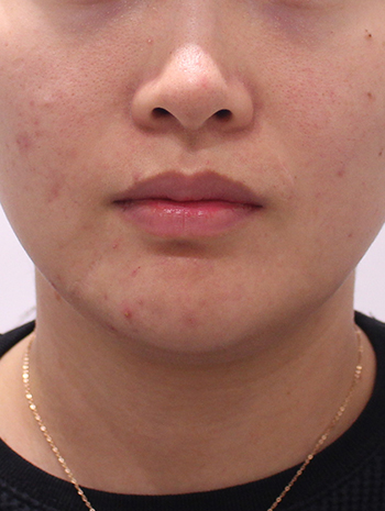 before image