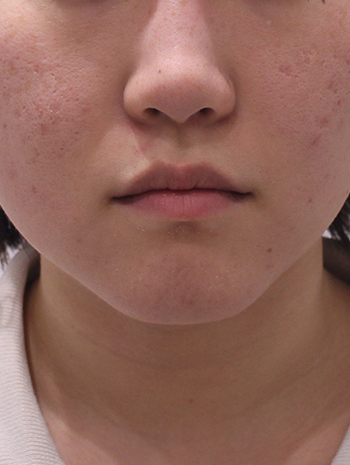 before image