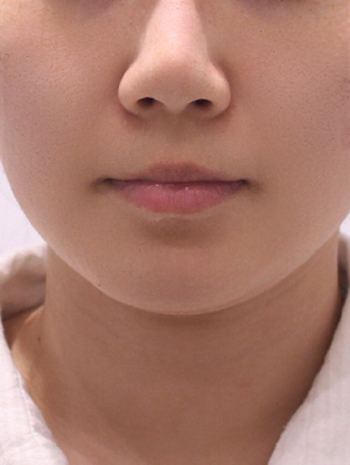 after image