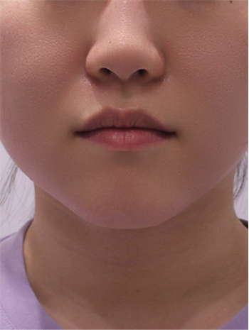 after image