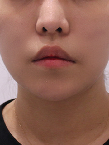 after image
