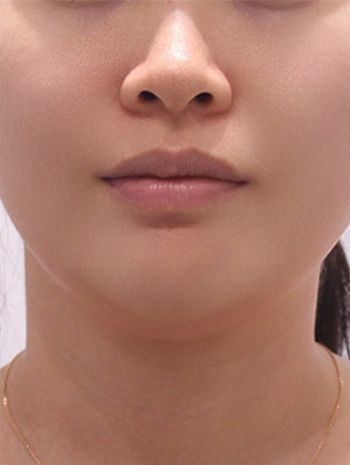 after image