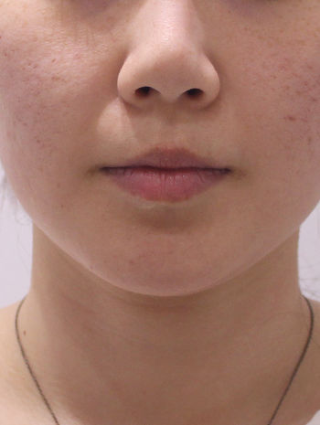 before image