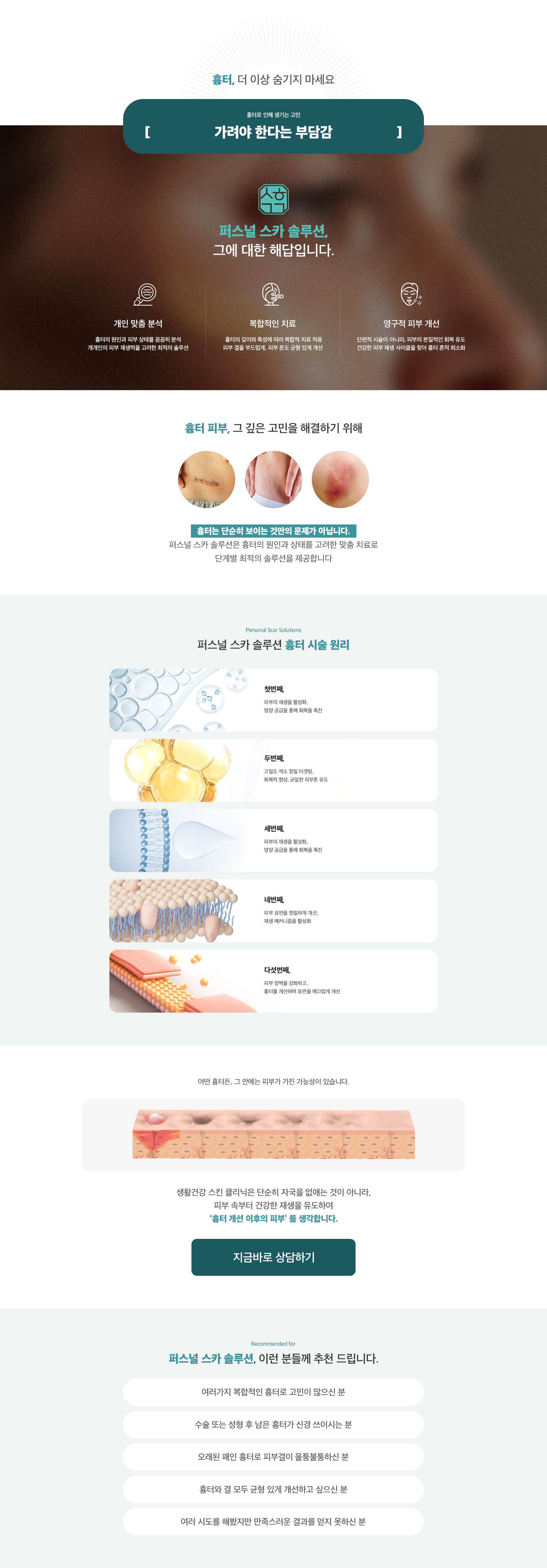 퍼스널 스카 솔루션