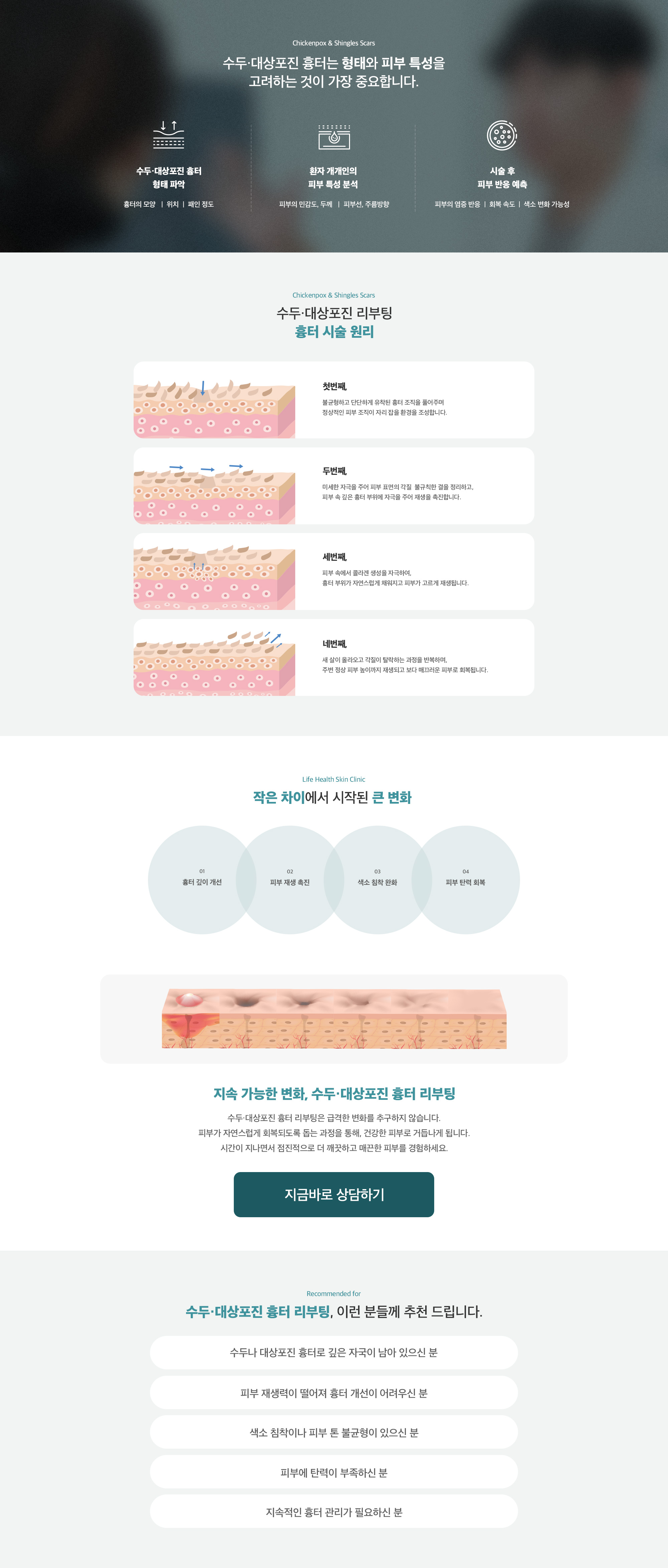 수두/대상포진 흉터