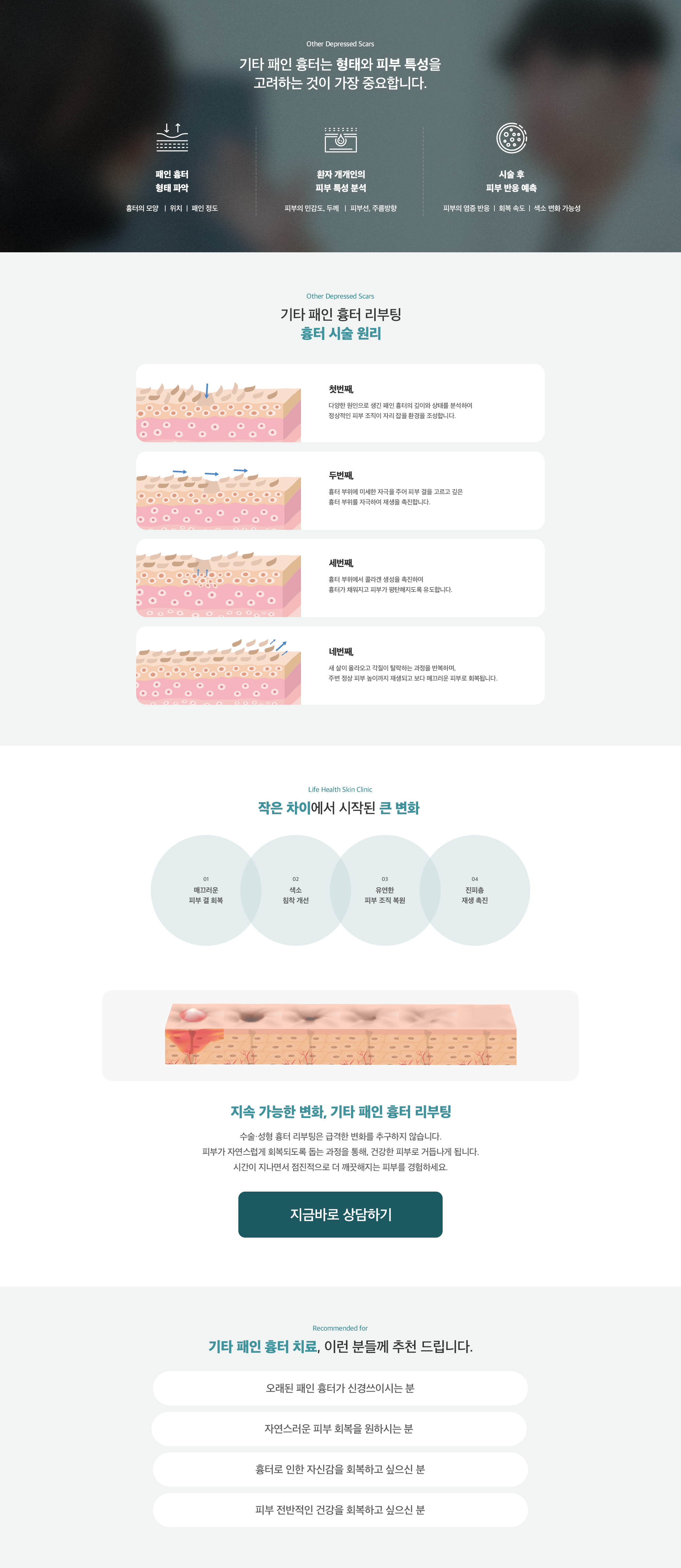 기타 패인 흉터